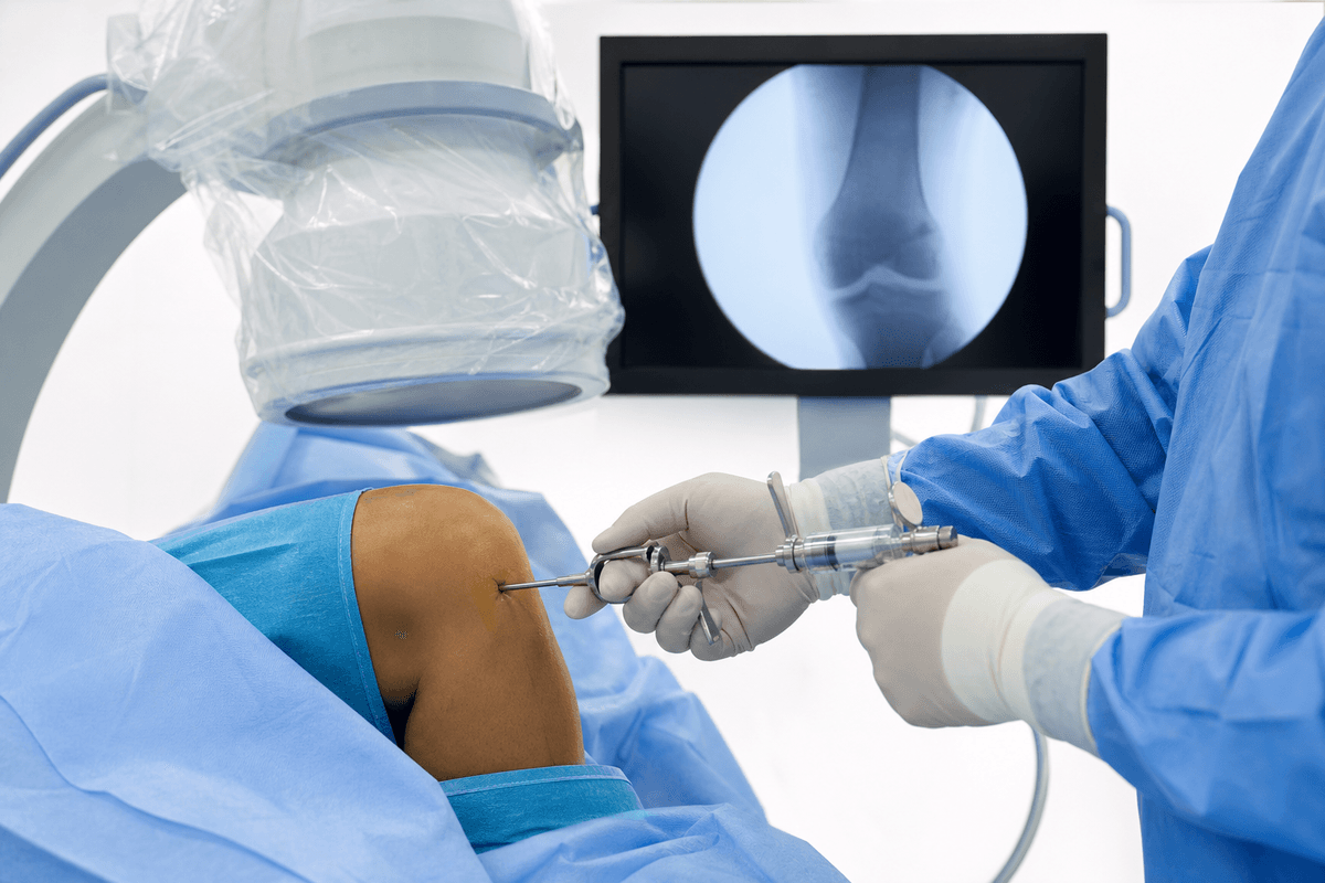 Aneurysmal Bone Cyst Treatment