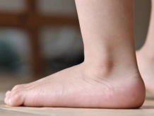 flatfoot causes, diagnosis, and management